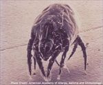 Dust Mite -Dermatophagoides farinae